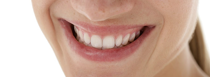 Parodontitis in Remscheid: Zahnfleischentzündung behandeln